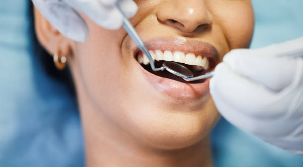 Best Teeth Whitening  in Sheldon, IL