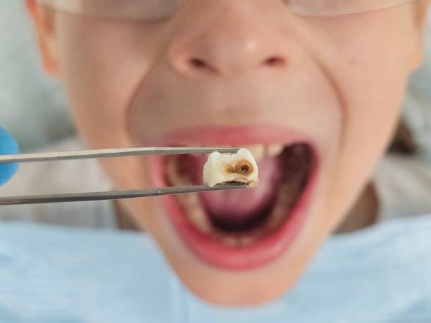 Best Broken Tooth Emergency  in Sheldon, IL
